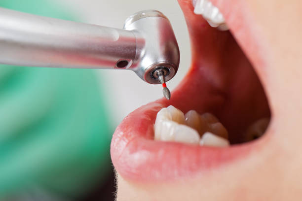 Best Emergency Dentist for Special Needs Patients in Ravensworth, VA